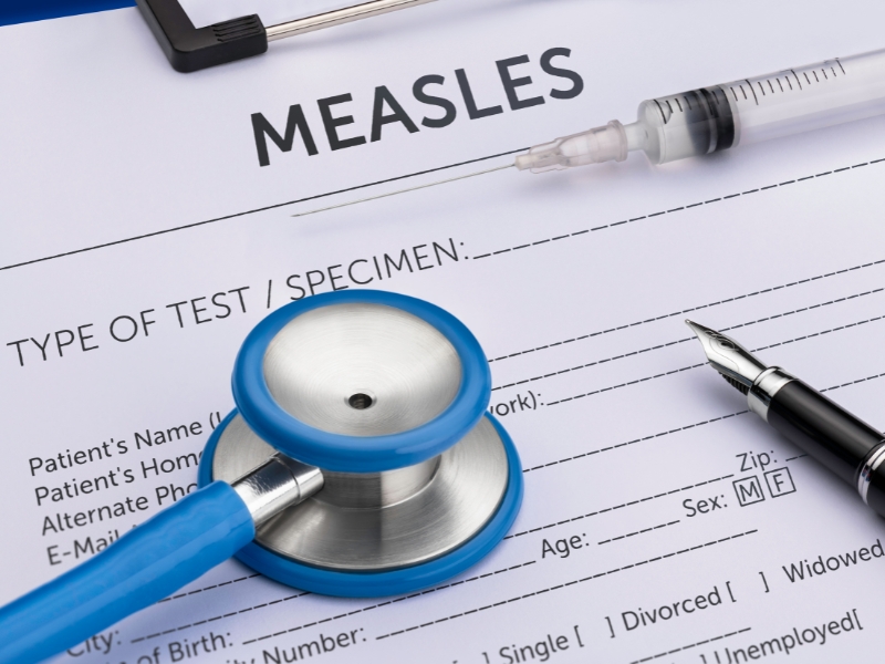 Measles Stock Image